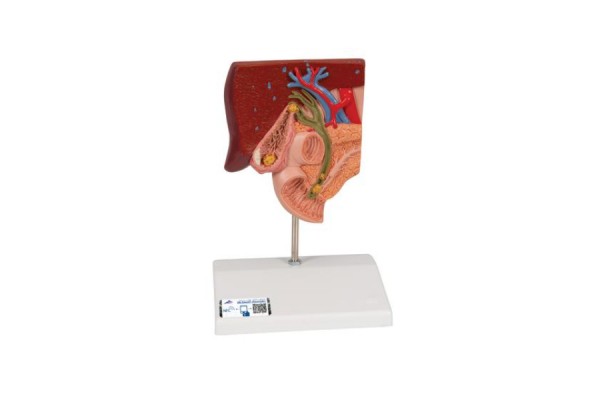 model kamieni żółciowych - 3b smart anatomy - 1000314 [k26] 3b scientific modele anatomiczne 2